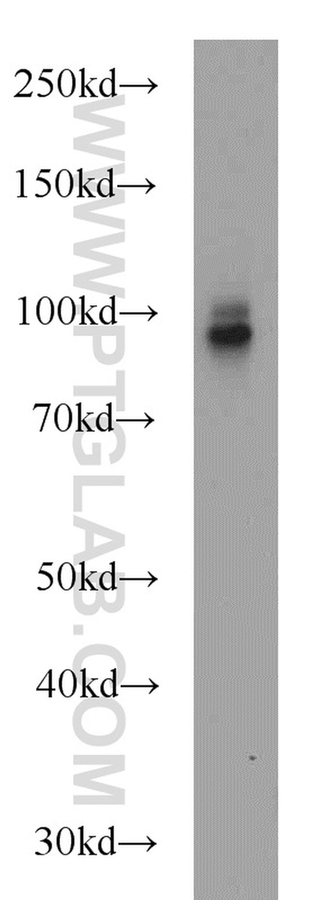 CD39/ENTPD1 Antibody in Western Blot (WB)
