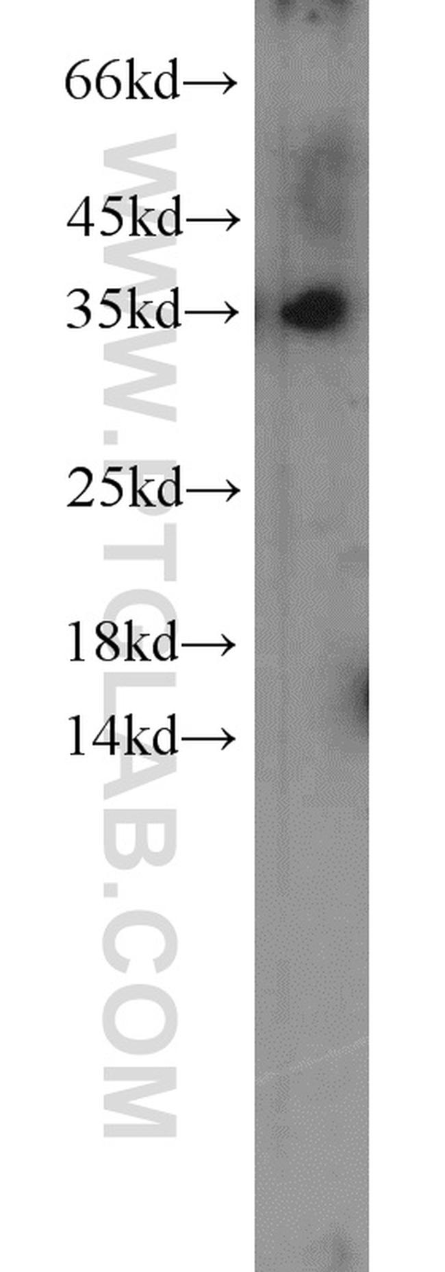 CDK1 Antibody in Western Blot (WB)