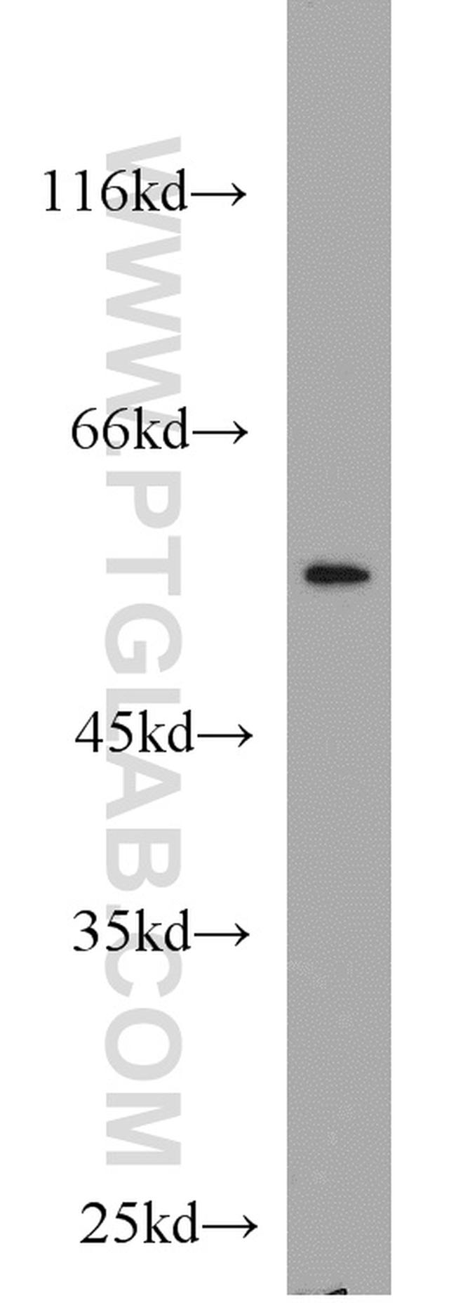 RUNX1 (N-terminal) Antibody in Western Blot (WB)
