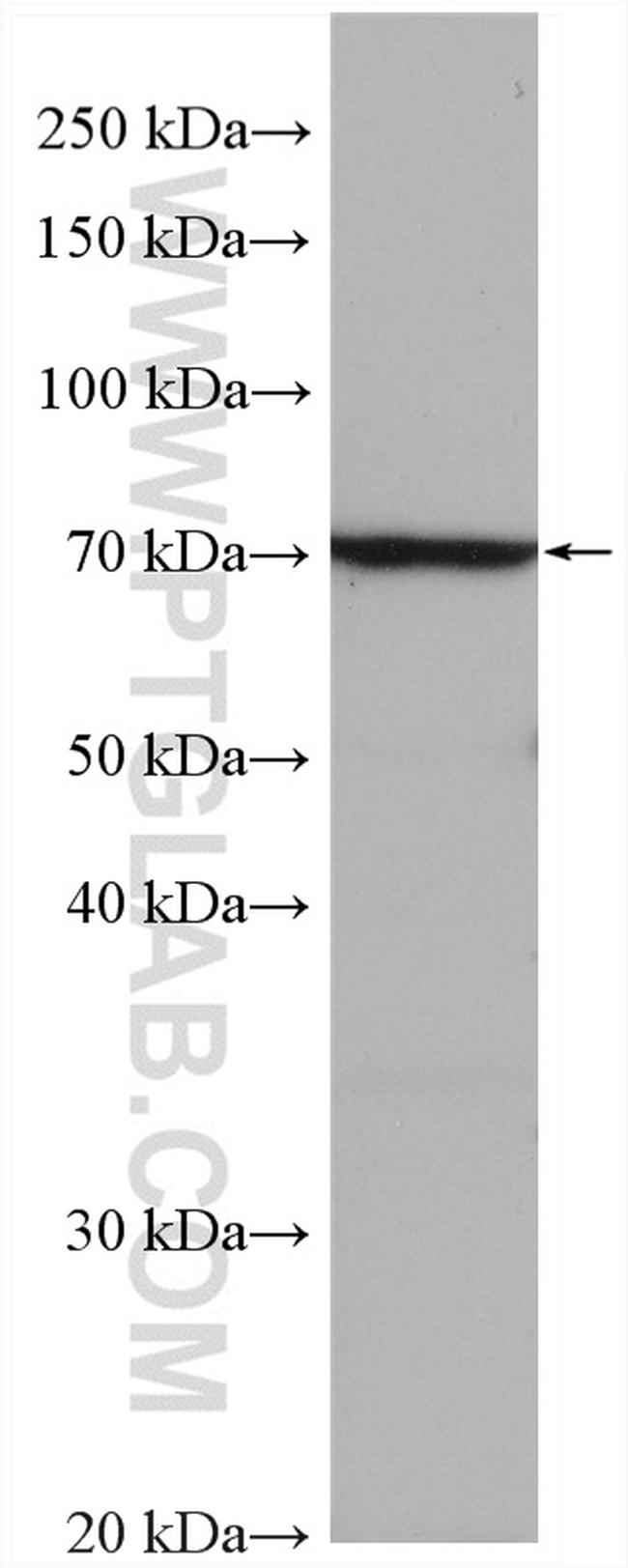 Serotonin transporter Antibody in Western Blot (WB)