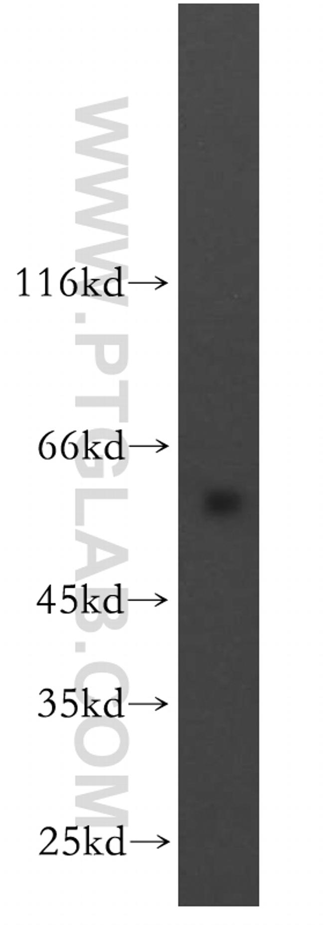 HYAL3 Antibody in Western Blot (WB)