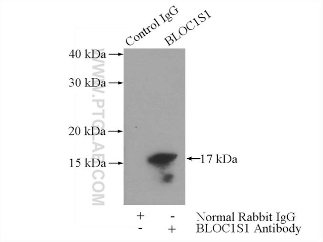 BLOC1S1 Antibody in Immunoprecipitation (IP)