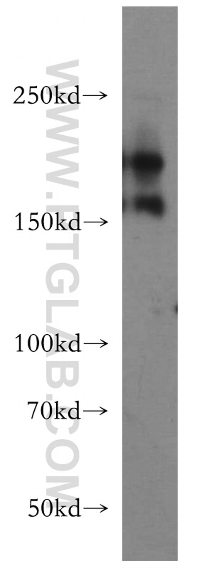 Tenascin-R Antibody in Western Blot (WB)