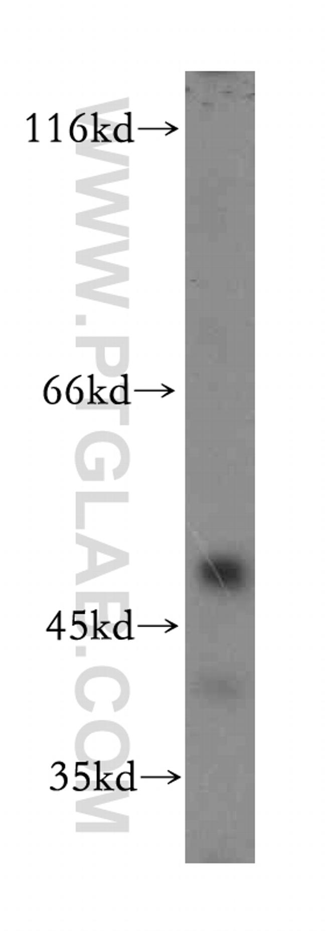 ADRA2B Antibody in Western Blot (WB)