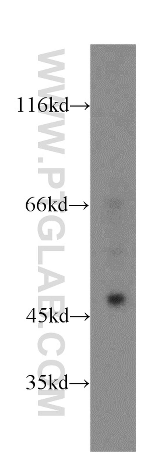 PHD2 Antibody in Western Blot (WB)