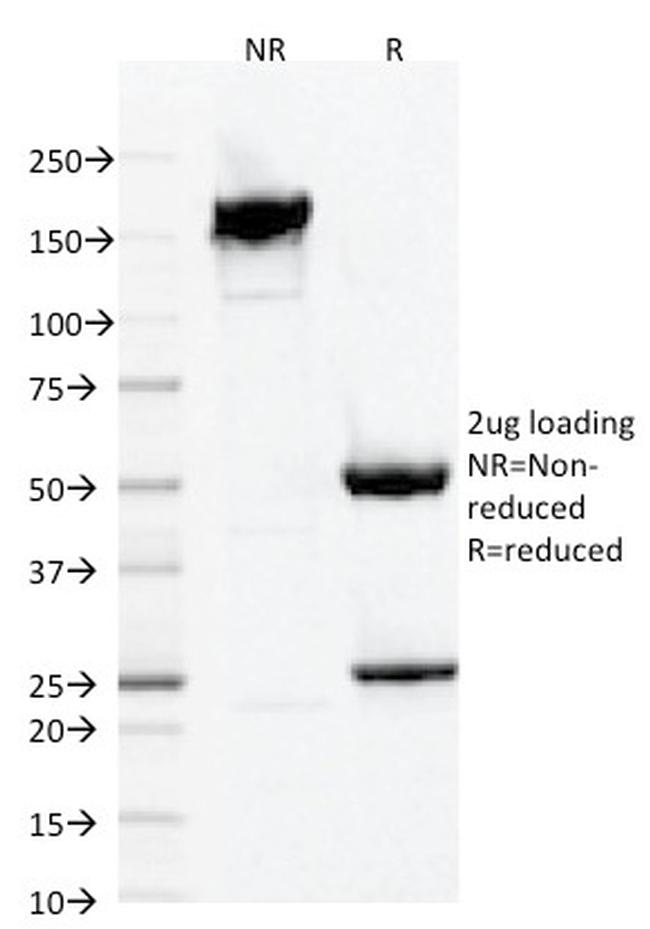 AIF1/Iba1 Antibody in SDS-PAGE (SDS-PAGE)