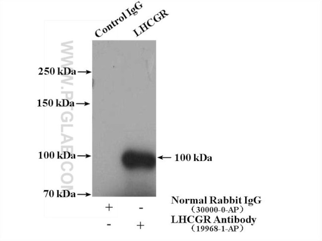 LHCGR Antibody in Immunoprecipitation (IP)