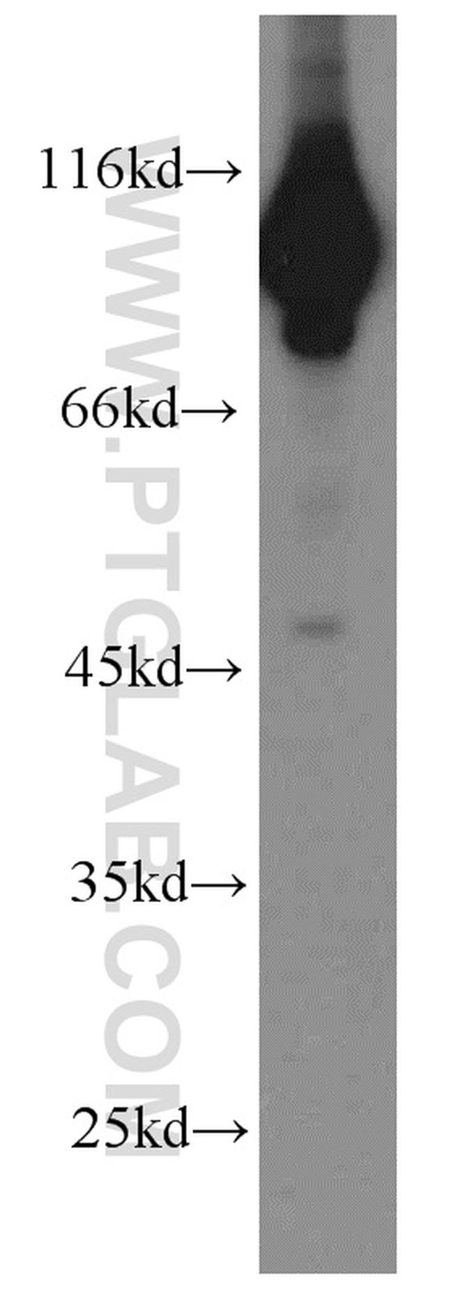 EEF2 Antibody in Western Blot (WB)