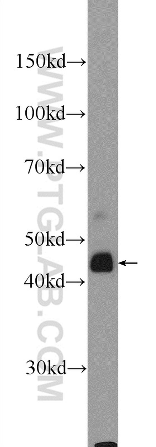 B4GALT6 Antibody in Western Blot (WB)