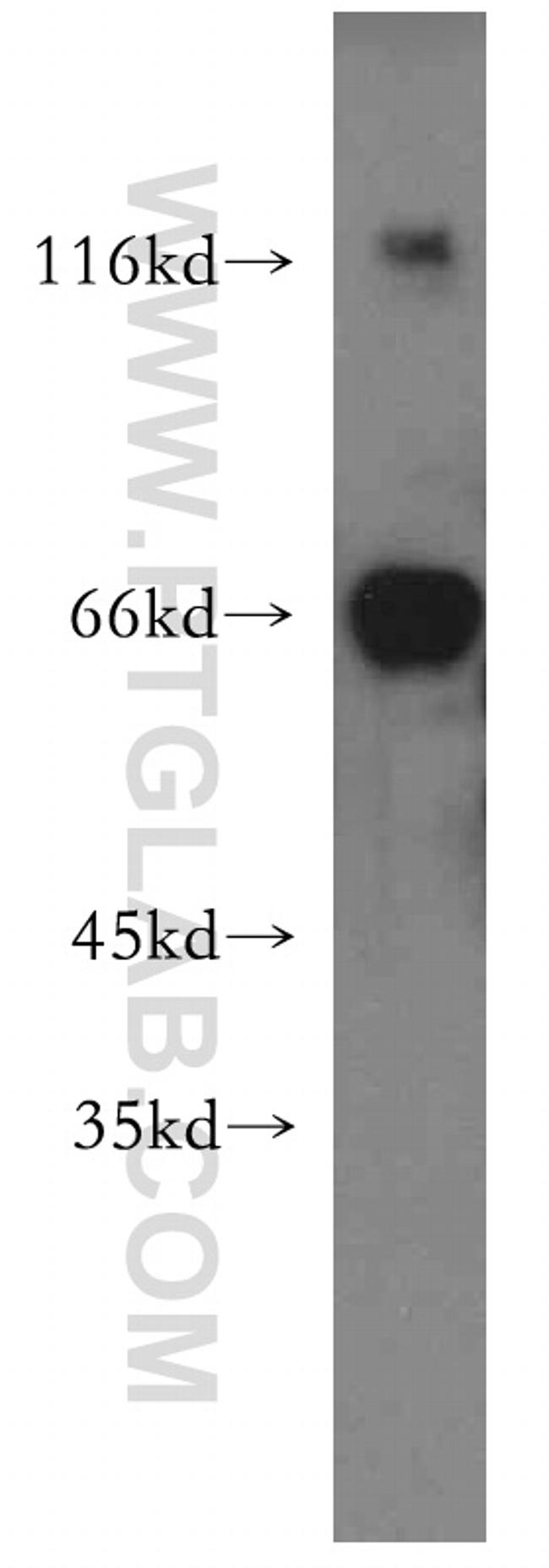 KGA Antibody in Western Blot (WB)