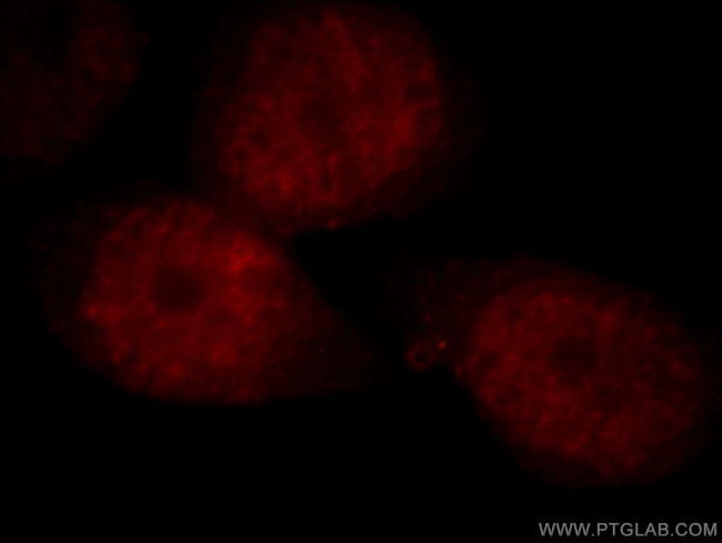 NCOA5 Antibody in Immunocytochemistry (ICC/IF)