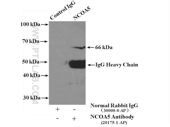 NCOA5 Antibody in Immunoprecipitation (IP)