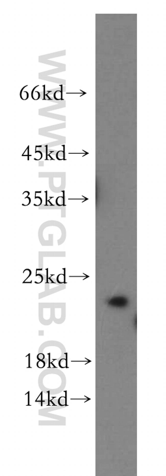 IGF1B Antibody in Western Blot (WB)