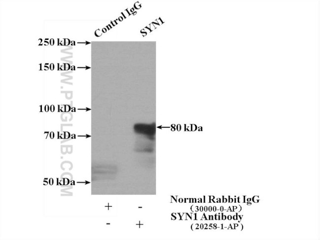 SYN1 Antibody in Immunoprecipitation (IP)