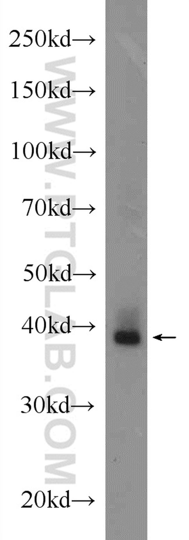 Adenosine A1 Receptor Antibody in Western Blot (WB)