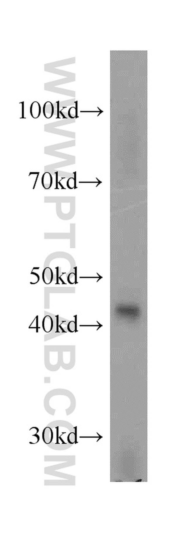 STAC3 Antibody in Western Blot (WB)