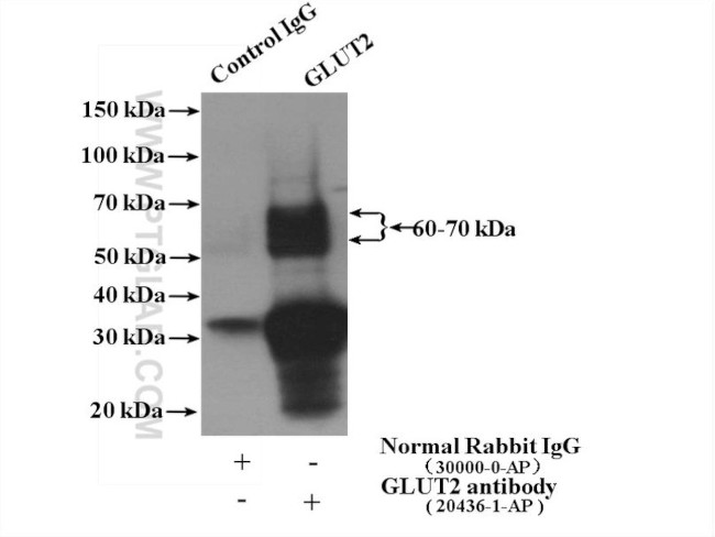 GLUT2 Antibody in Immunoprecipitation (IP)