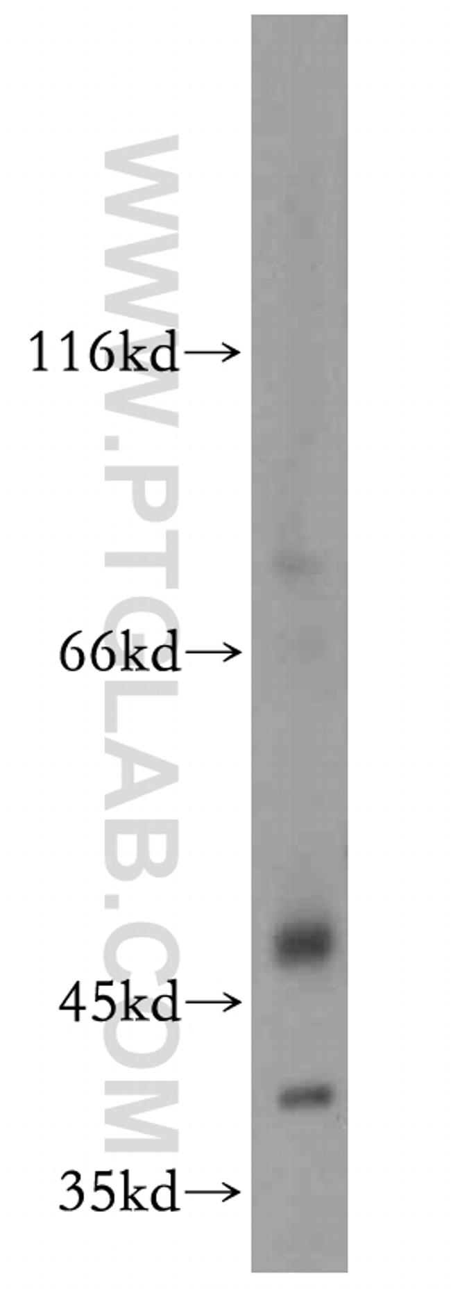 ZIP8 Antibody in Western Blot (WB)