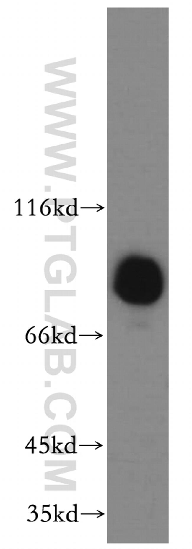 EPS8L2 Antibody in Western Blot (WB)