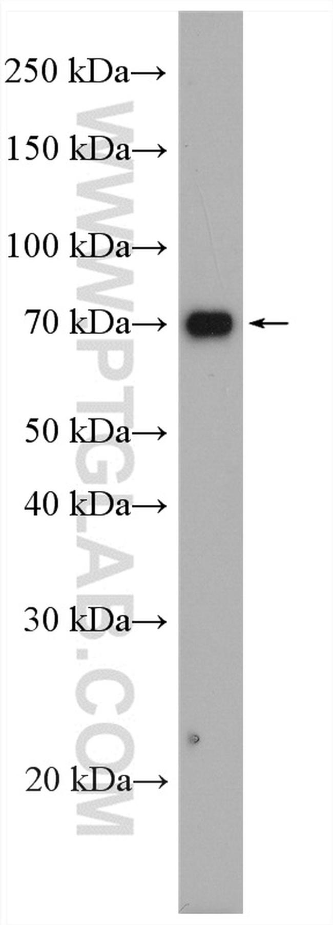 SLC11A2 Antibody in Western Blot (WB)
