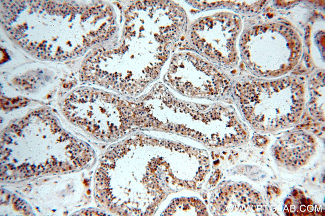 SLC16A12 Antibody in Immunohistochemistry (Paraffin) (IHC (P))