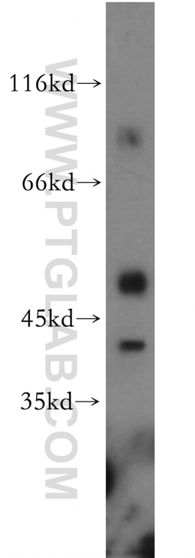 DOC2B Antibody in Western Blot (WB)