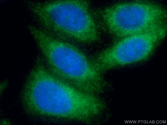 AGPAT9 Antibody in Immunocytochemistry (ICC/IF)