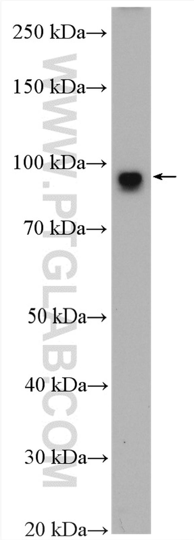 PSD95/DLG4 Antibody in Western Blot (WB)