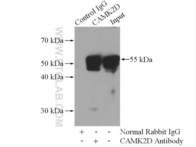CaMKII delta Antibody in Immunoprecipitation (IP)