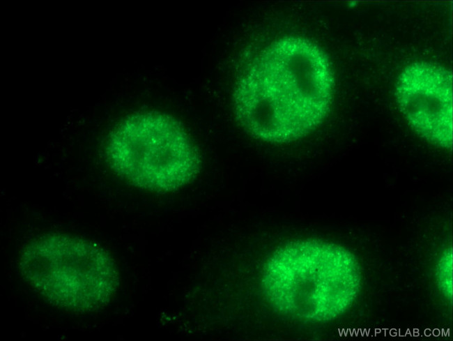 TOP1 Antibody in Immunocytochemistry (ICC/IF)