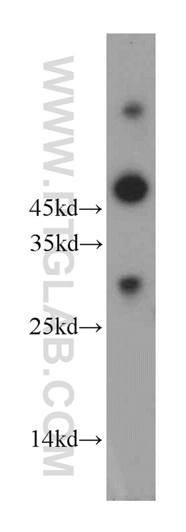 FAM57B Antibody in Western Blot (WB)
