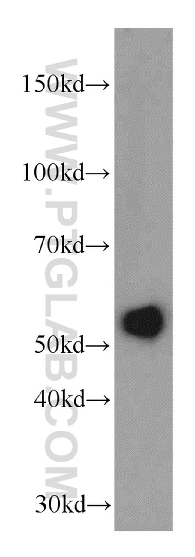 TRMT2B Antibody in Western Blot (WB)
