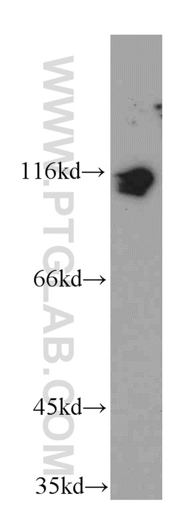 KDM1 Antibody in Western Blot (WB)