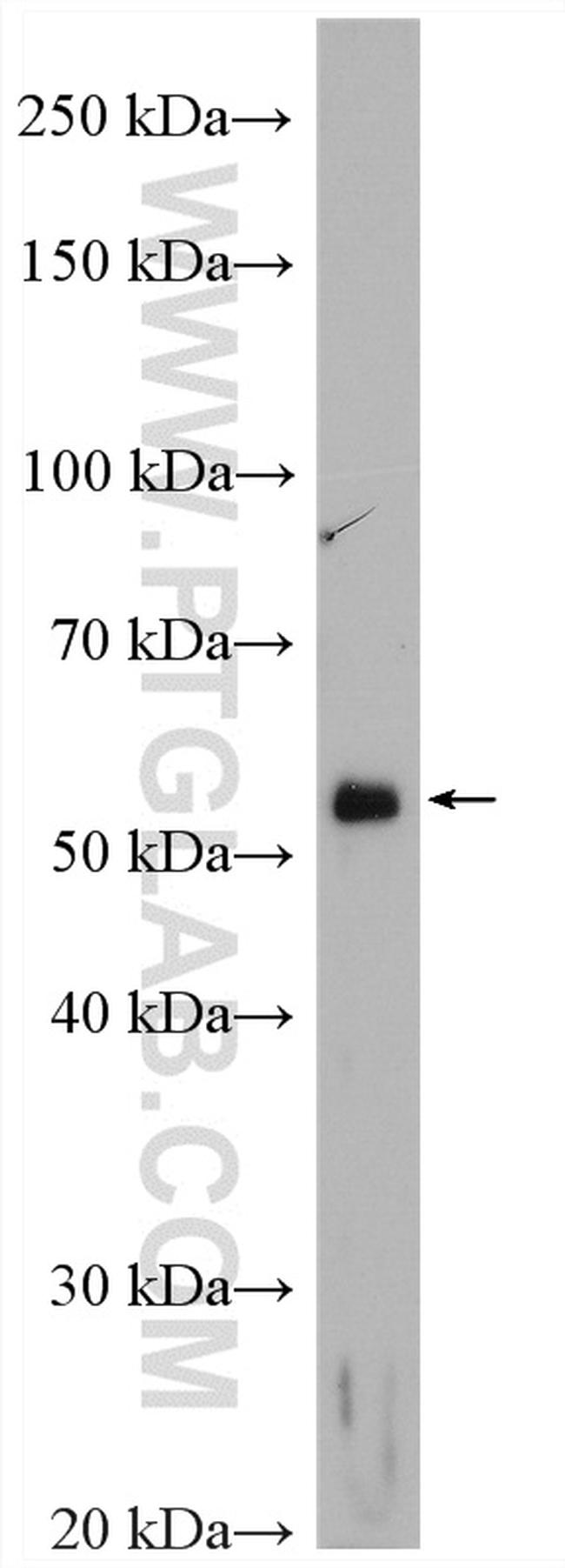 VMAT2 Antibody in Western Blot (WB)