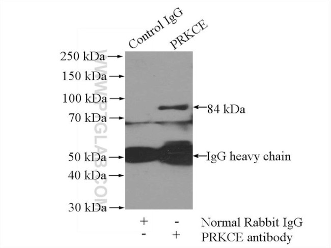 PKC epsilon Antibody in Immunoprecipitation (IP)