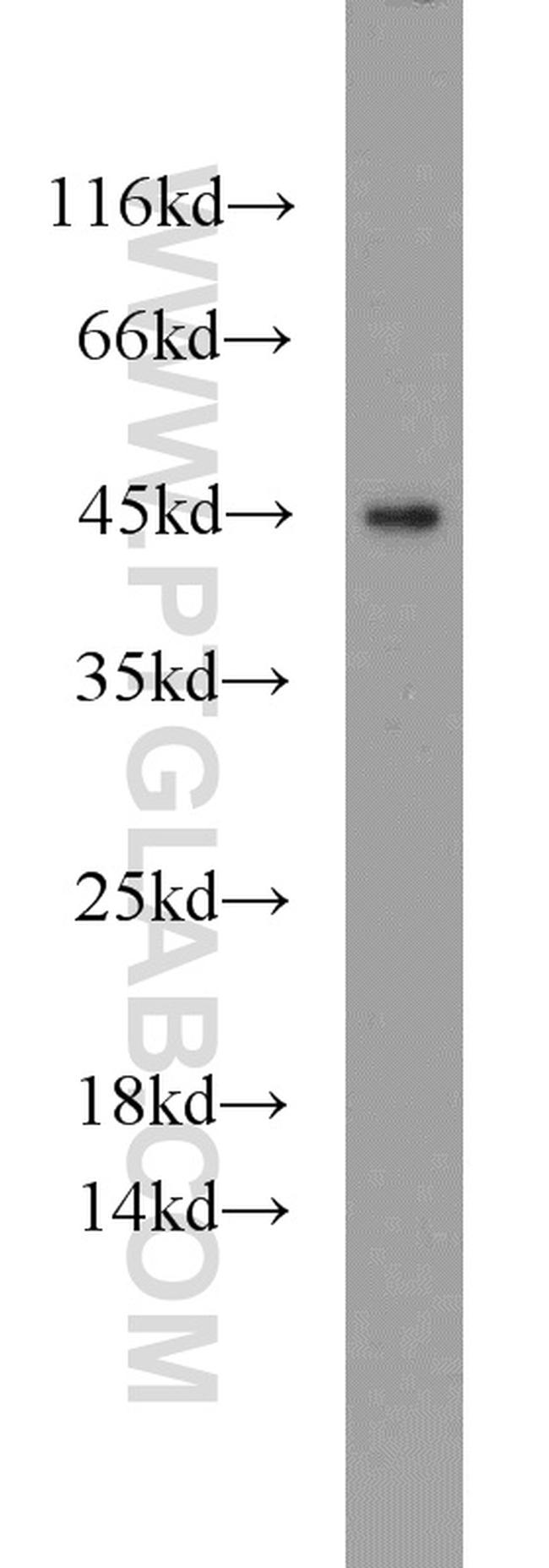 C3orf21 Antibody in Western Blot (WB)