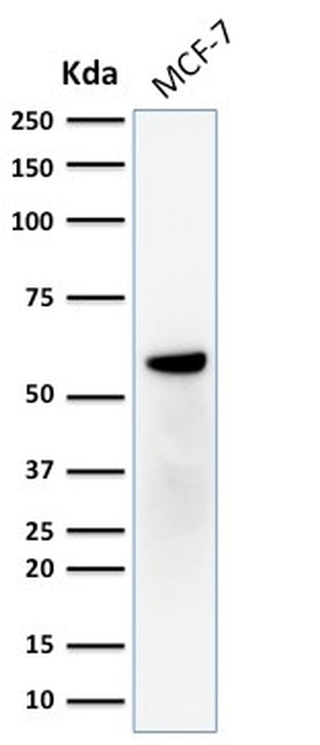 ER-beta-1 (Estrogen Receptor beta-1) Antibody in Western Blot (WB)
