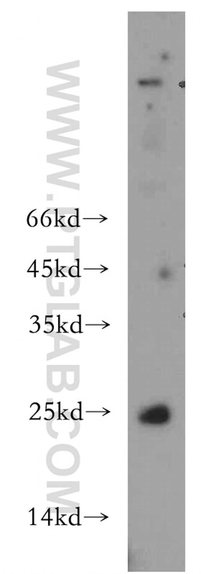 CHCHD4 Antibody in Western Blot (WB)