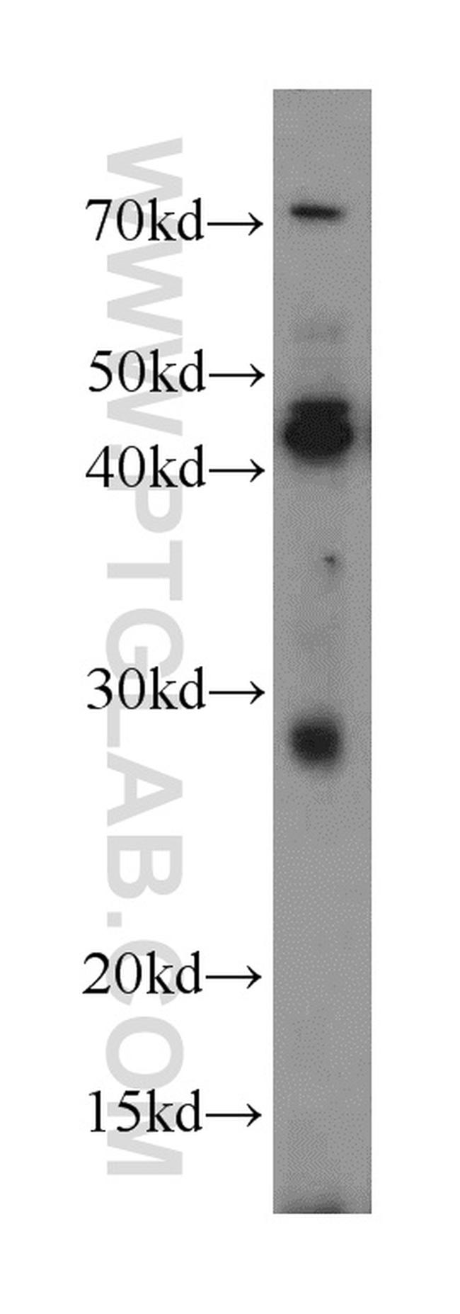 SPACA3 Antibody in Western Blot (WB)