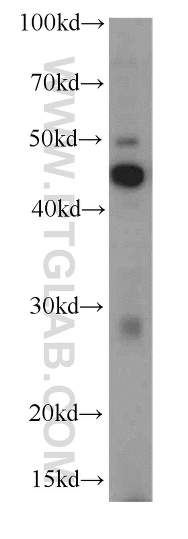 SPACA3 Antibody in Western Blot (WB)