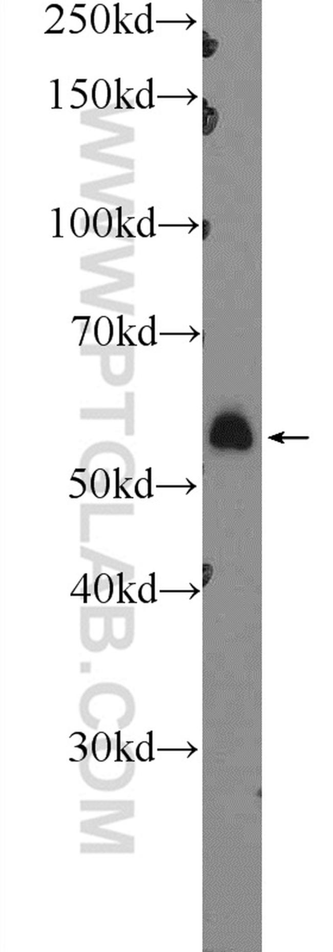 PPM2C Antibody in Western Blot (WB)