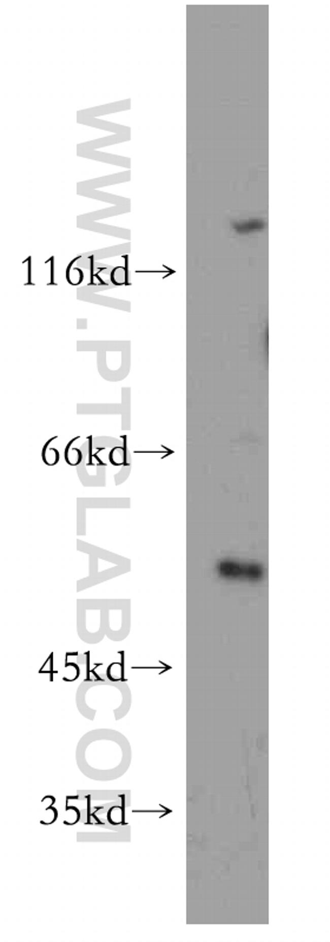 CBLL1 Antibody in Western Blot (WB)