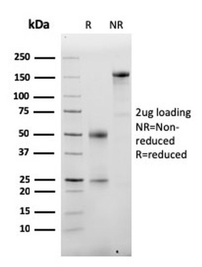 Albumin (Transport Protein) Antibody in SDS-PAGE (SDS-PAGE)