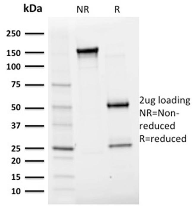 Albumin (Transport Protein) Antibody in SDS-PAGE (SDS-PAGE)