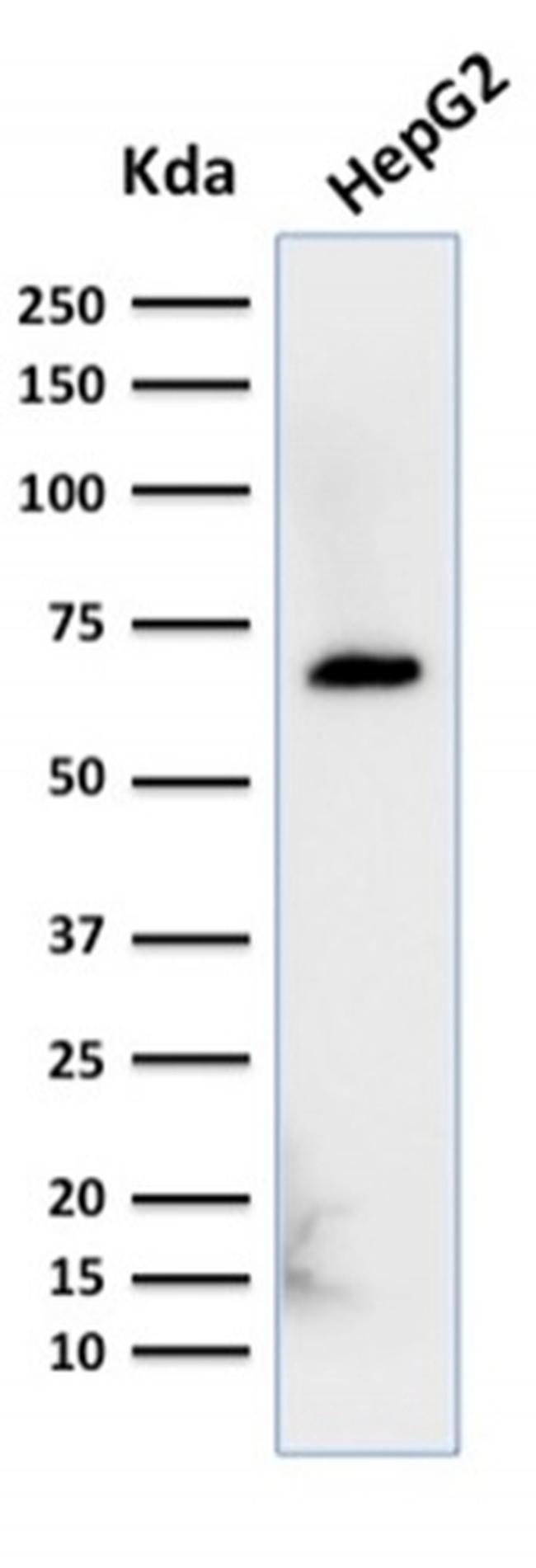 Albumin (Transport Protein) Antibody in Western Blot (WB)