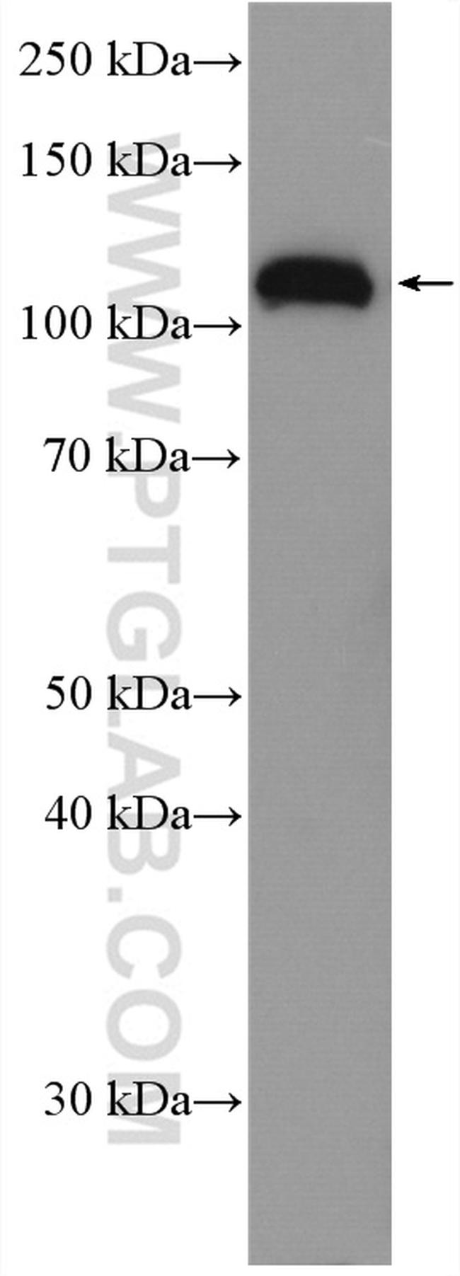 C3/C3b/C3c Antibody in Western Blot (WB)