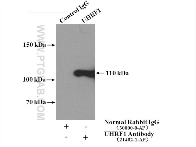 UHRF1 Antibody in Immunoprecipitation (IP)