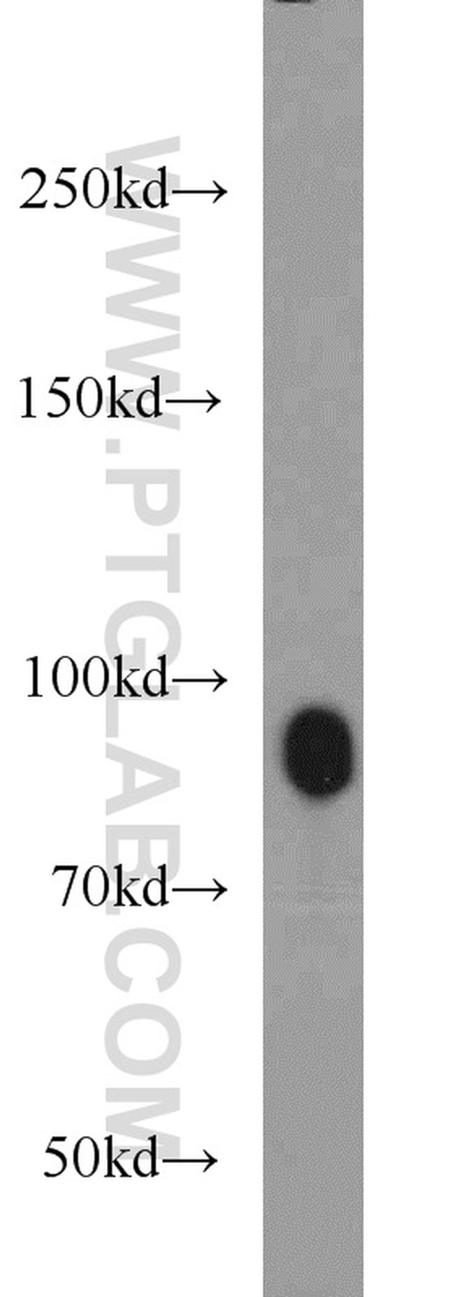 UHRF1 Antibody in Western Blot (WB)