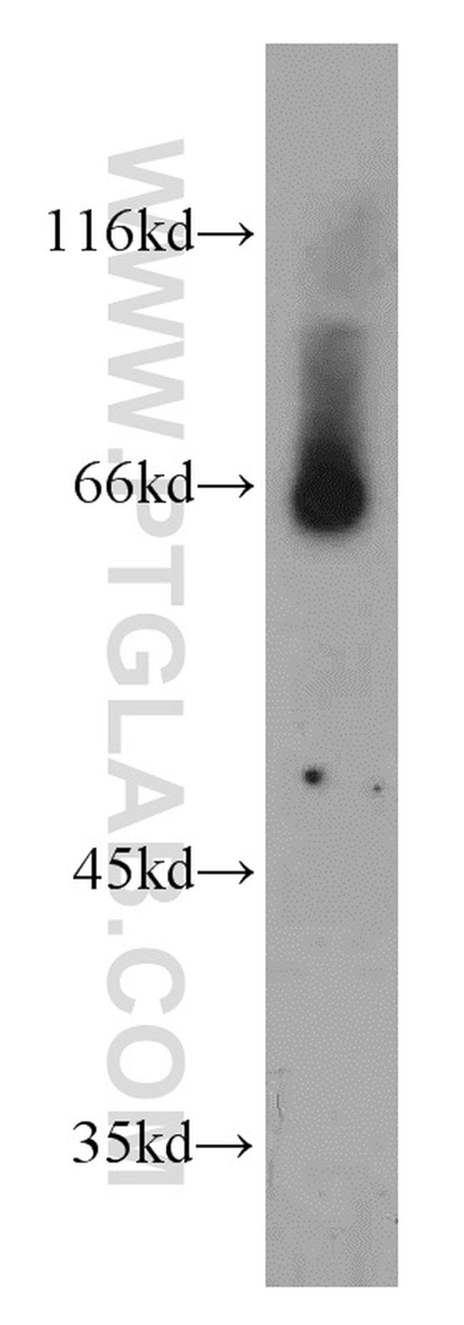 SLC24A6 Antibody in Western Blot (WB)