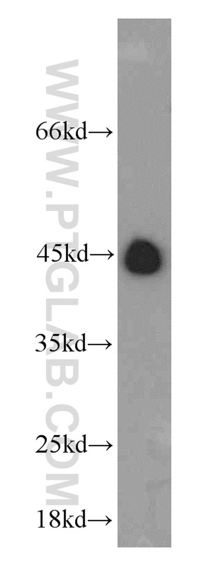 RNF150 Antibody in Western Blot (WB)